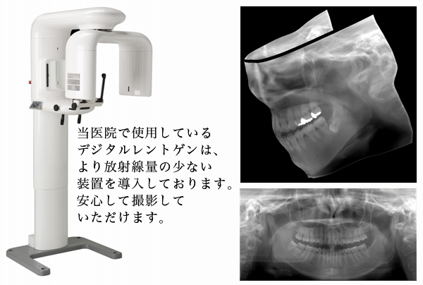 ヒアルロン酸